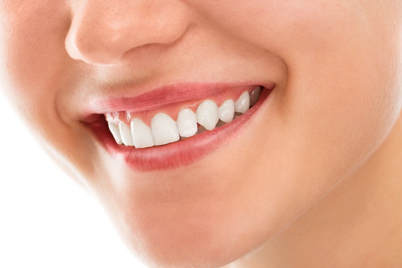 Teeth Whitening Coral Gables