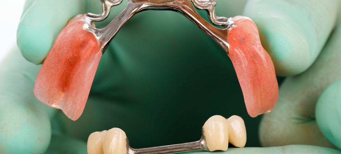 dentures-partials in CORAL GABELS FL
