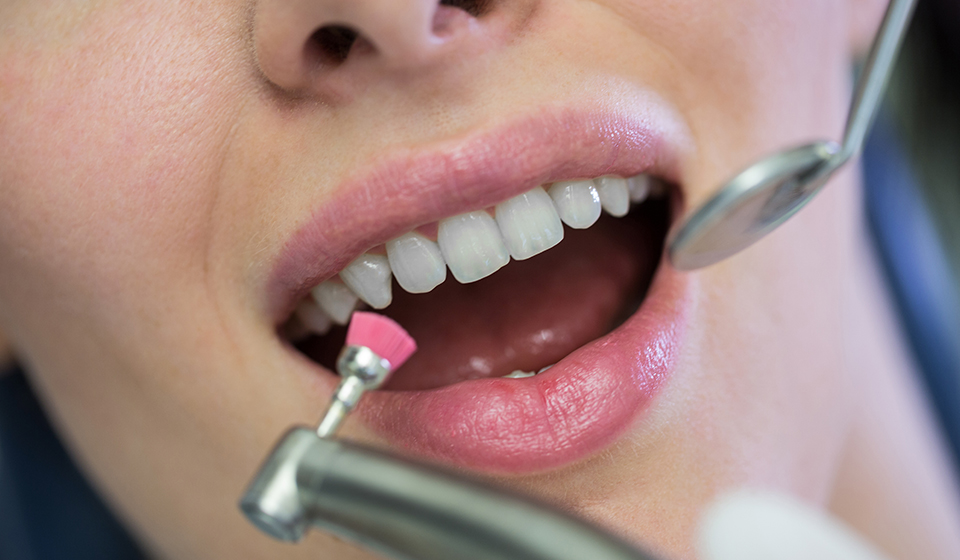 Cosmetic dentistry in Coral Gables FL